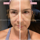 Creme Antirrugas Instantâneo - (Compre 1 Leve 2) ®