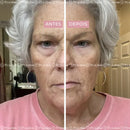 Creme Antirrugas Instantâneo - (Compre 1 Leve 2) ®