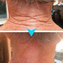 (Kit com 3 Unidades) Creme de Pele Anti-Rugas e Flacidez Fubsta Hoygi- Resultados em 10 Dias de Uso