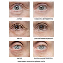 Creme Antirrugas Instantâneo - (Compre 1 Leve 2) ®