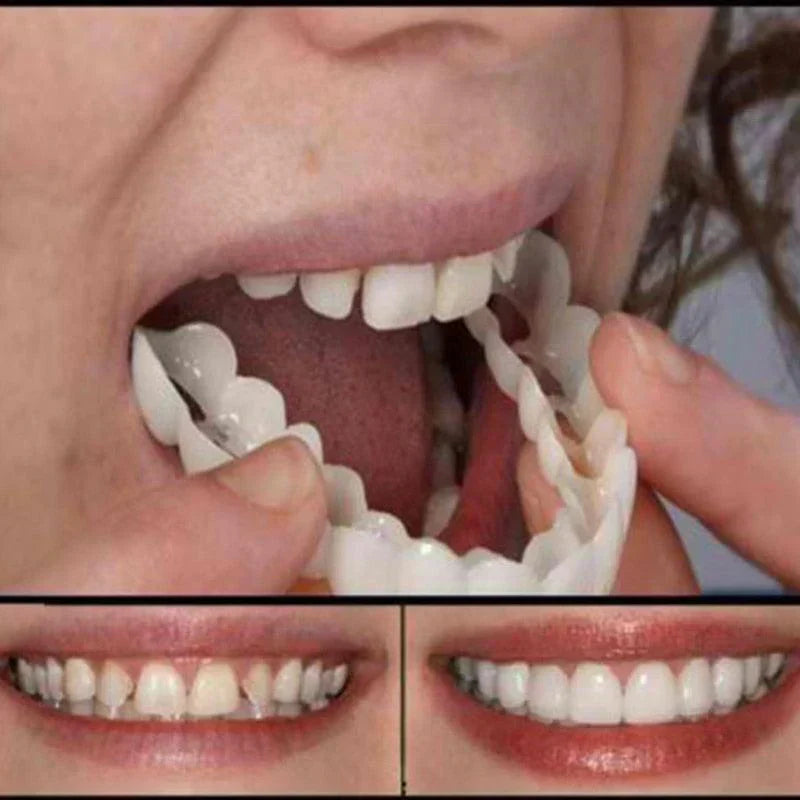 (Compre 1 Leve 2) Lente Dental Ajustável - Inferior e Superior | BRINDE CAPINHA PROTETORA + FRETE GRÁTIS!
