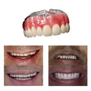 Dentadura Universal NewSmile | Ajustável e Adaptativel (Compre 1 Peça leve 2)