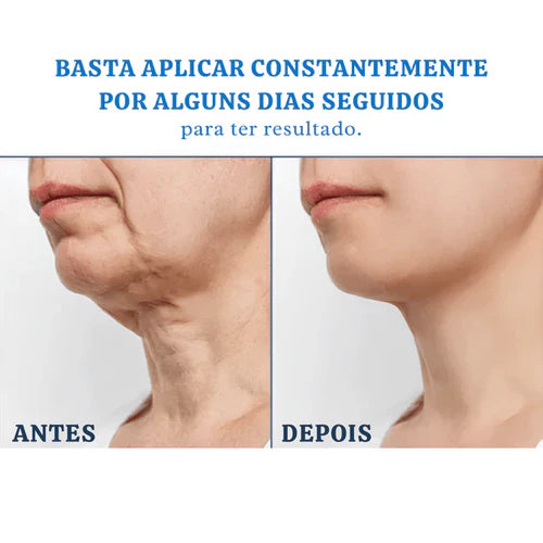 (Kit com 3 Unidades) Creme de Pele Anti-Rugas e Flacidez Fubsta Hoygi- Resultados em 10 Dias de Uso