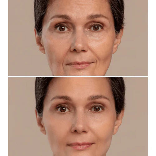 (Kit com 3 Unidades) Creme de Pele Anti-Rugas e Flacidez Fubsta Hoygi- Resultados em 10 Dias de Uso