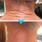 (Kit com 3 Unidades) Creme de Pele Anti-Rugas e Flacidez Fubsta Hoygi- Resultados em 10 Dias de Uso