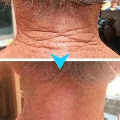 (Kit com 3 Unidades) Creme de Pele Anti-Rugas e Flacidez Fubsta Hoygi- Resultados em 10 Dias de Uso