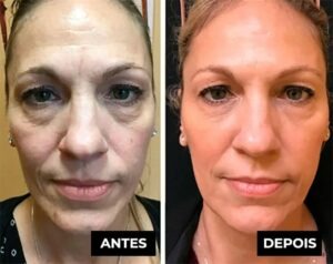 [Compre 1 Leve 2] Rolon 5 em 1 Ultra Rejuvenescedor - Luteína Glow + BRINDE