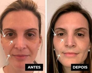 [Compre 1 Leve 2] Rolon 5 em 1 Ultra Rejuvenescedor - Luteína Glow + BRINDE